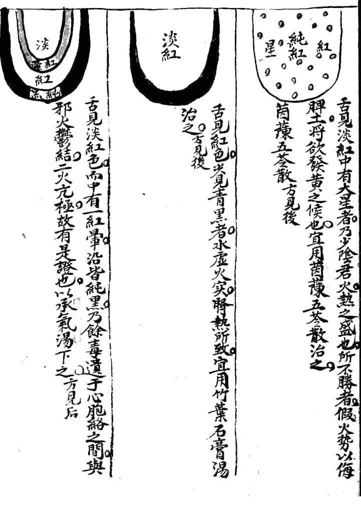 《伤寒钤法》插图11