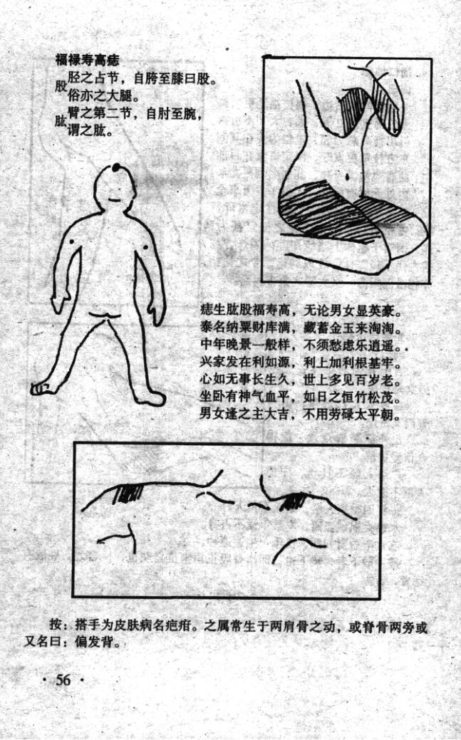 《痣斑命相大全》插图9