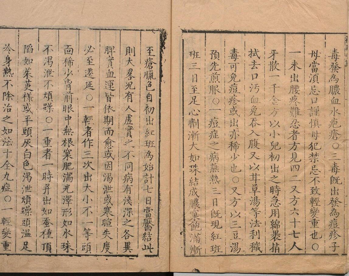 秘传经验痘疹良方 ３卷 明刊本插图3
