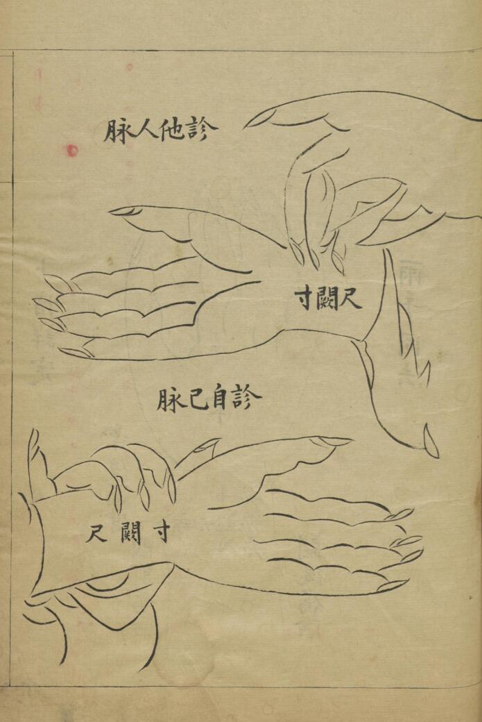 脉理正宗.[清乾隆]郎毓純参辑.清光绪二十四年赵群生抄本插图5