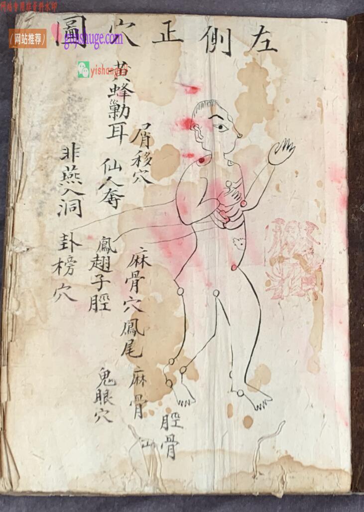 《梅山张五郎跌打医书》